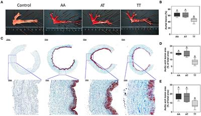 Associations of the T329S Polymorphism in Flavin-Containing Monooxygenase 3 With Atherosclerosis and Fatty Liver Syndrome in 90-Week-Old Hens